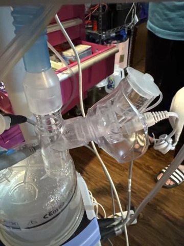 Home Care Compressor Nebulizer